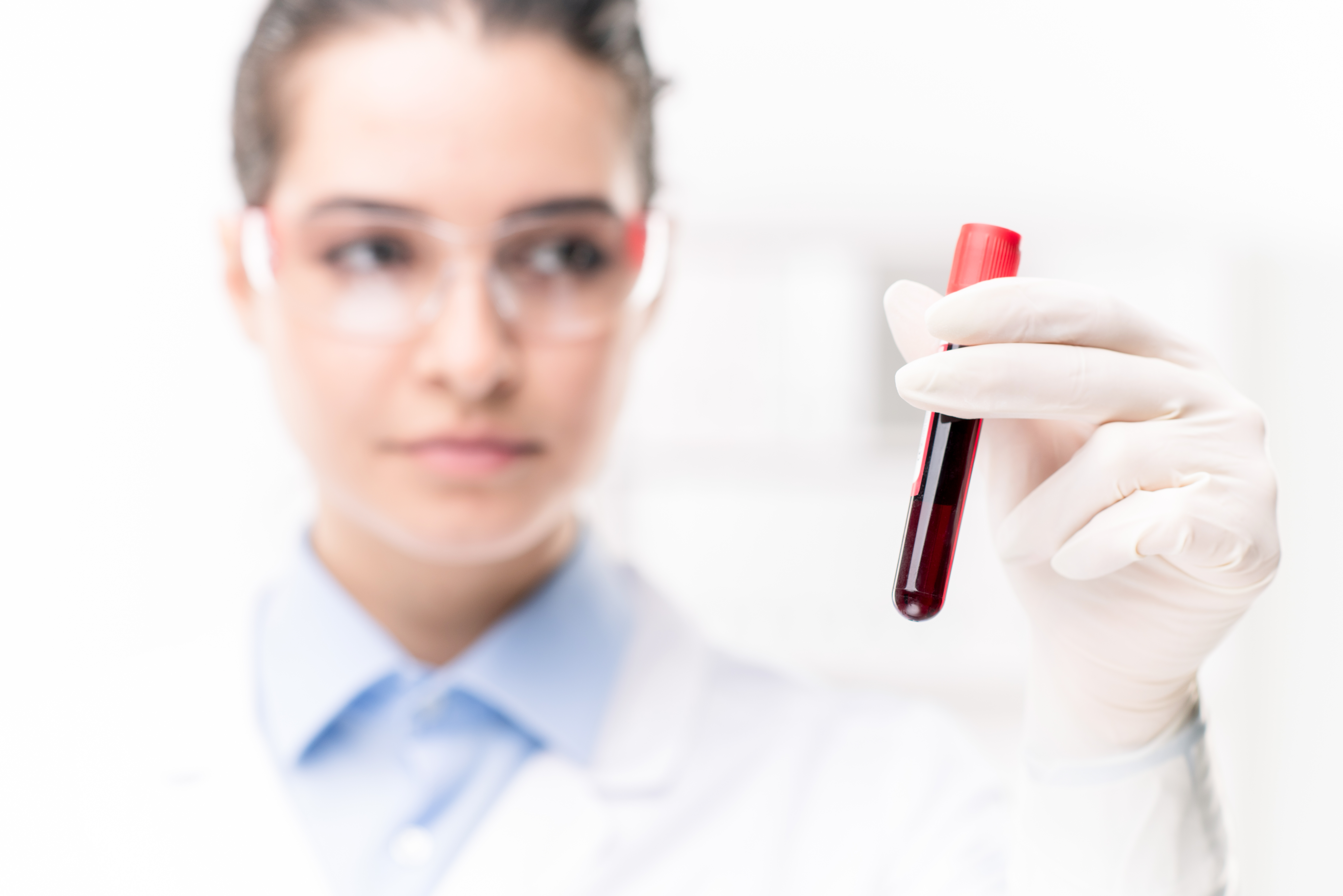Liquid Biopsy - Blutanalyse